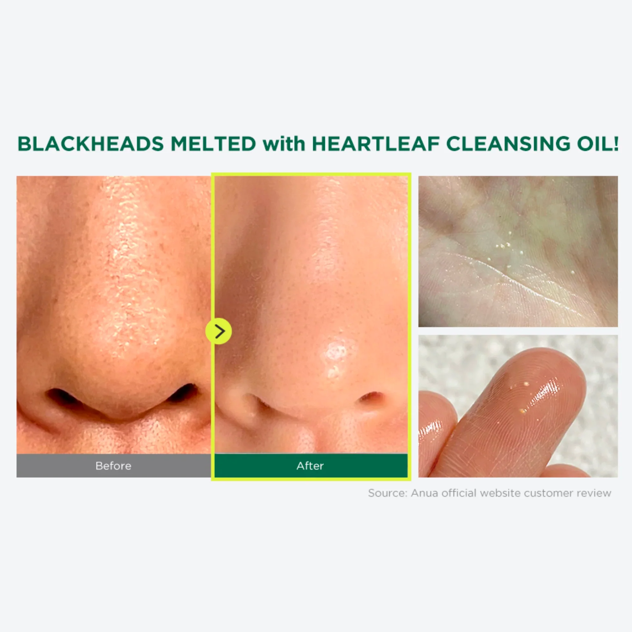 [Special Sale] Heartleaf Pore Control Cleansing Oil Mini (20ml) - Image 2